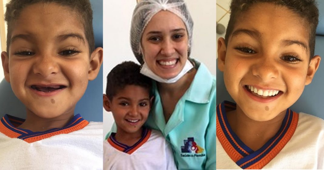 Dentista devolve o sorriso de menino de 6 anos que não tinha nenhum dente! Ato de amor emocionou as redes!