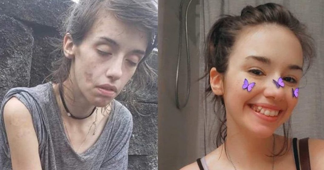 Jovem de 24 anos supera vício em drogas e se deslumbra com sua nova aparência.