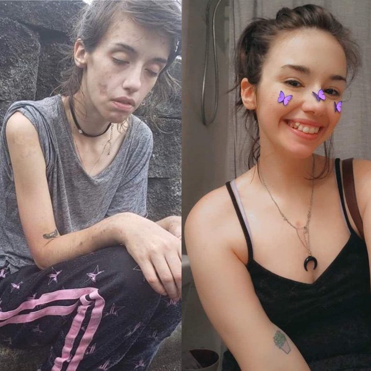 seuamigoguru.com - Jovem de 24 anos supera vício em drogas e se deslumbra com sua nova aparência.