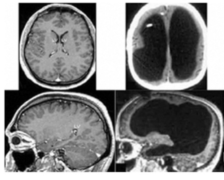 seuamigoguru.com - Neurologista estuda cérebro de estudante que é constituído basicamente de água