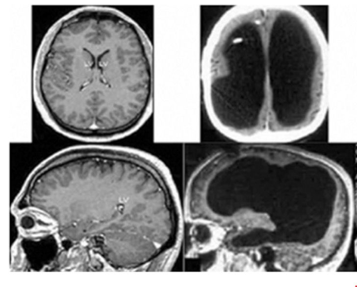 seuamigoguru.com - Neurologista estuda cérebro de estudante que é constituído basicamente de água