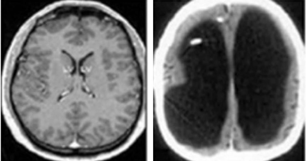 Neurologista estuda cérebro de estudante que é constituído basicamente de água