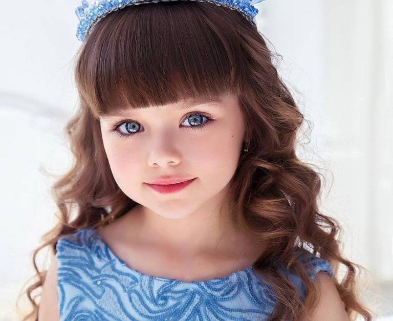 seuamigoguru.com - Criança Russa eleita a ‘menina mais bonita do mundo’ – Hoje enfrenta preconceito.