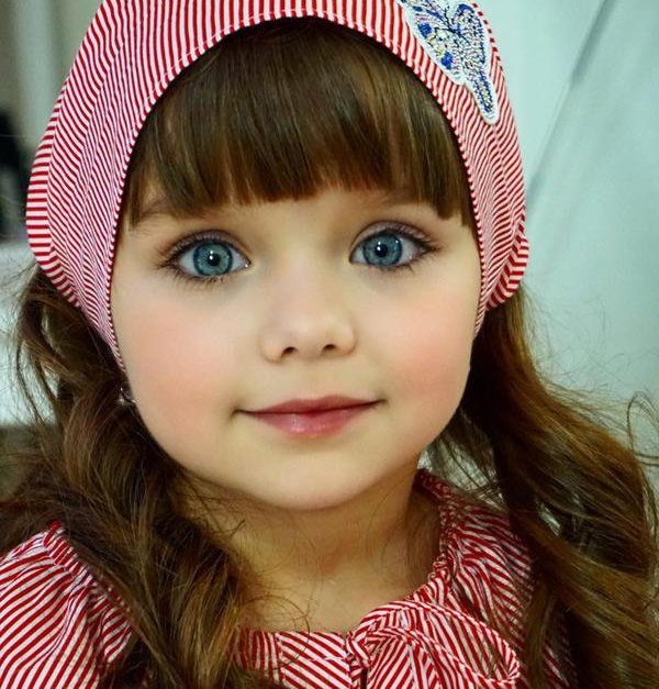 seuamigoguru.com - Criança Russa eleita a ‘menina mais bonita do mundo’ – Hoje enfrenta preconceito.