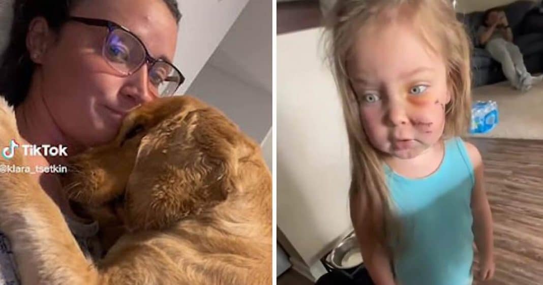 Mãe se recusa a expulsar cachorro de casa após ele morder a filha: “Foi em legítima defesa”